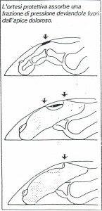 ortoplastica