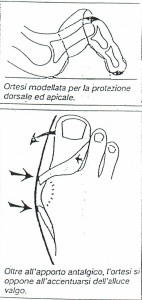 ortoplastica