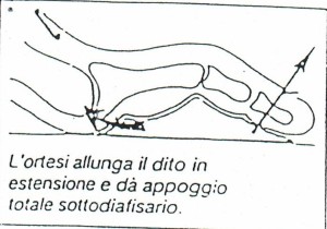Ortoplastica